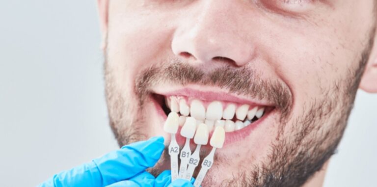 Chicago Cosmetic Dentistry: Cutting-Edge Treatments for a Perfect Smile